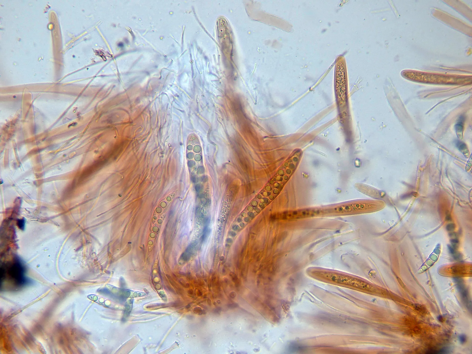 Microscopía de Lophiostoma macrostomum - 11 - Ascos x 400-001